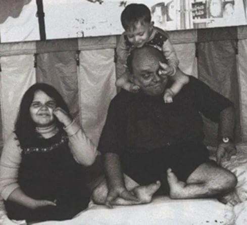 Story Of Grady Stiles The Lobster Boy Sometimes Interesting