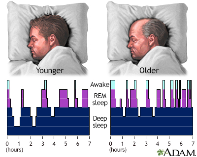 30, 2021, between service employees international union (seiu) local 32bj and the realty advisory board on labor relations, inc. Sleep disorders in the elderly Information | Mount Sinai - New York