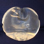 Saline Breast Implant, Columbus, OH