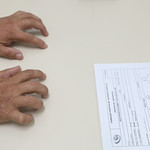 Hansen&iacute;ase: diagn&oacute;stico precoce e acolhimento transformam vidas