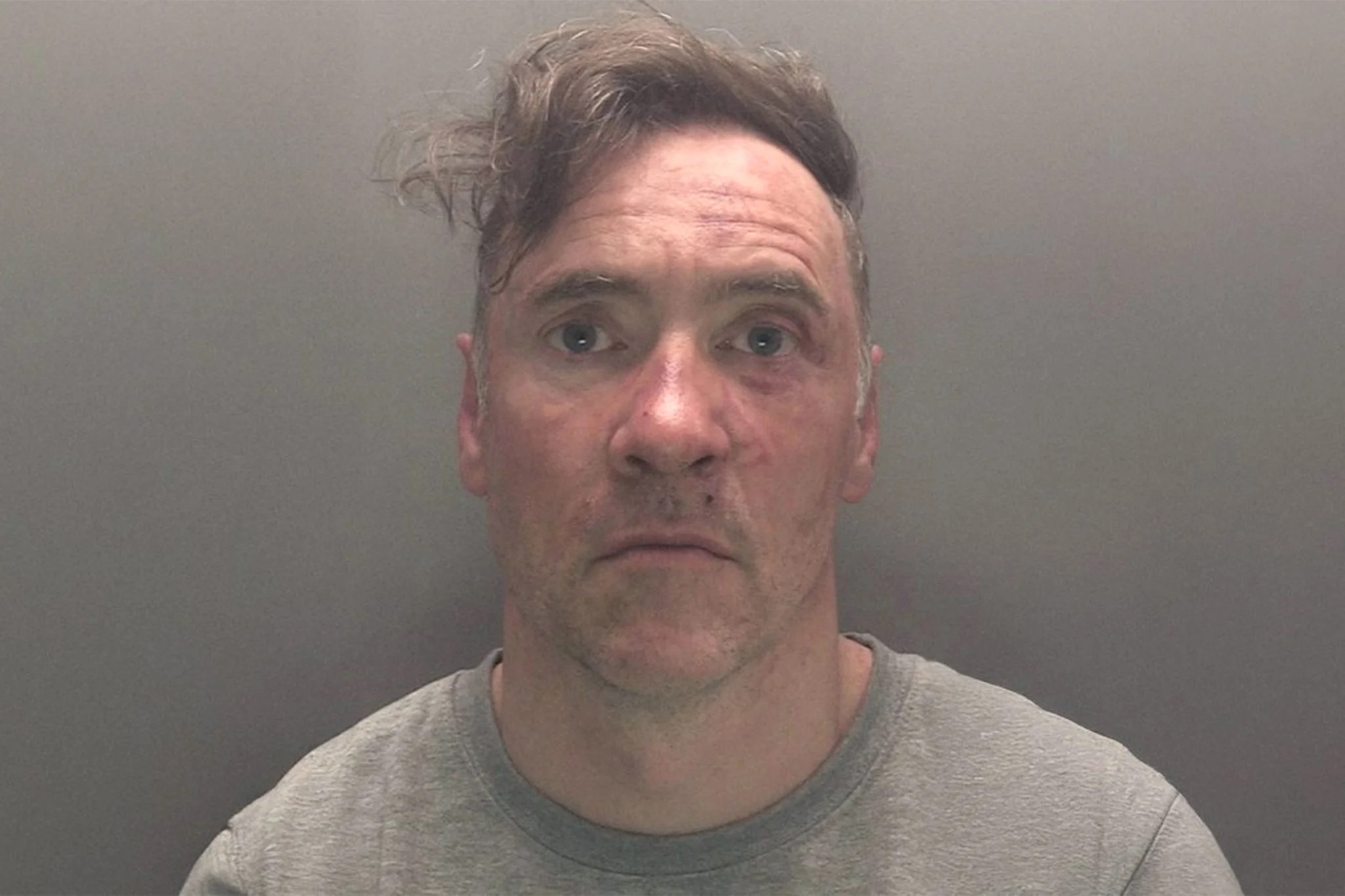 Paul Doyle: Veteran tells how Liverpool parade attacker bit off part of his ear in vicious assault