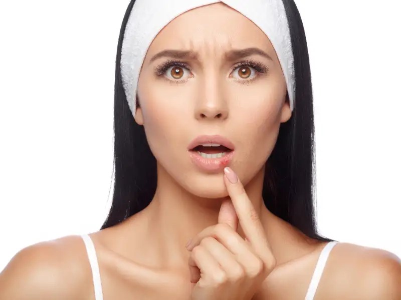 Skin cancer on the lip is common but often overlooked; 5 Habits That Are Making Your Lips Dark The Times Of India