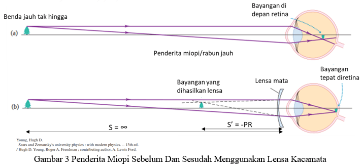 Cahaya dan Alat Optik - Tanya MIPI