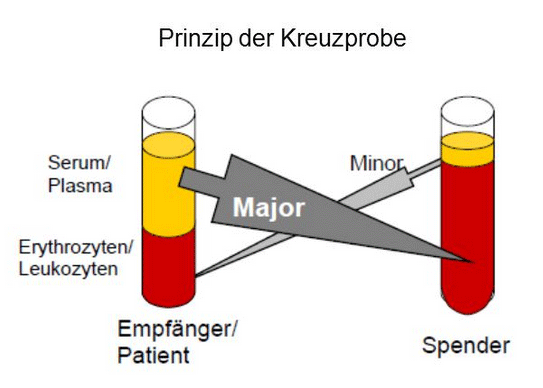 Blut im stuhl und die darmspiegelung. Kreuzprobe