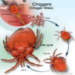 Chiggers. Everything you never wanted to know, but should.