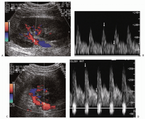 Abdominal Vasculature | Thoracic Key