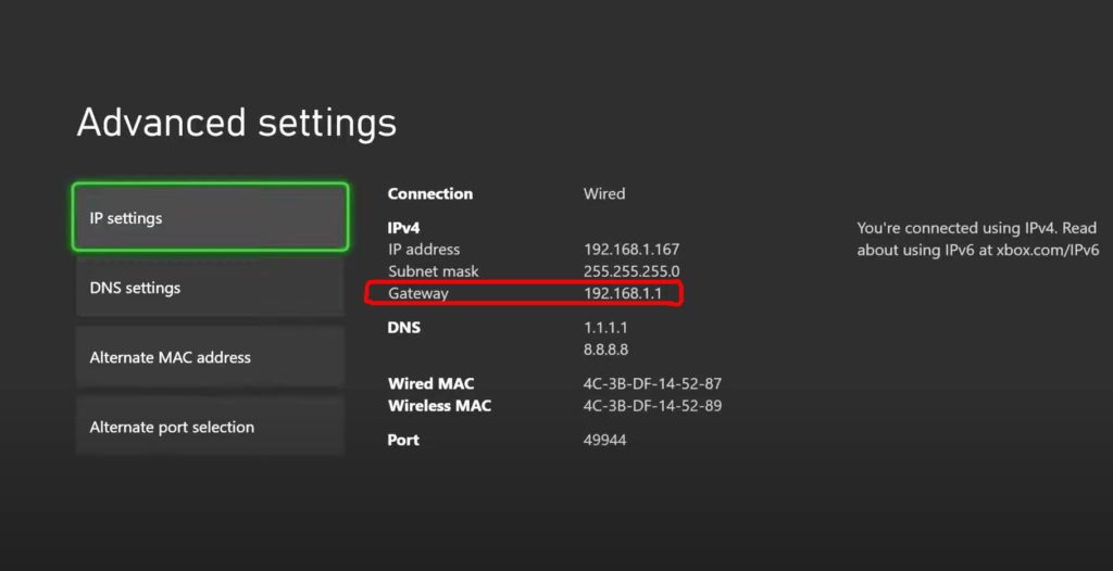 But your isp assigns you a public ip address that other devices on the internet can see. How to Set Up a Static IP Address on Xbox Series X (DHCP