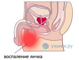 Название заболевания: Эпидемический паротит. Прививка от паротита