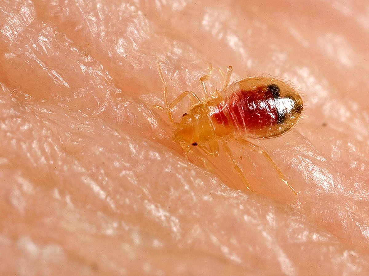 Bed bug bite vs mosquito bite. Do You Have a Bed Bug Infestation?: Tiny Black Bugs in Bed