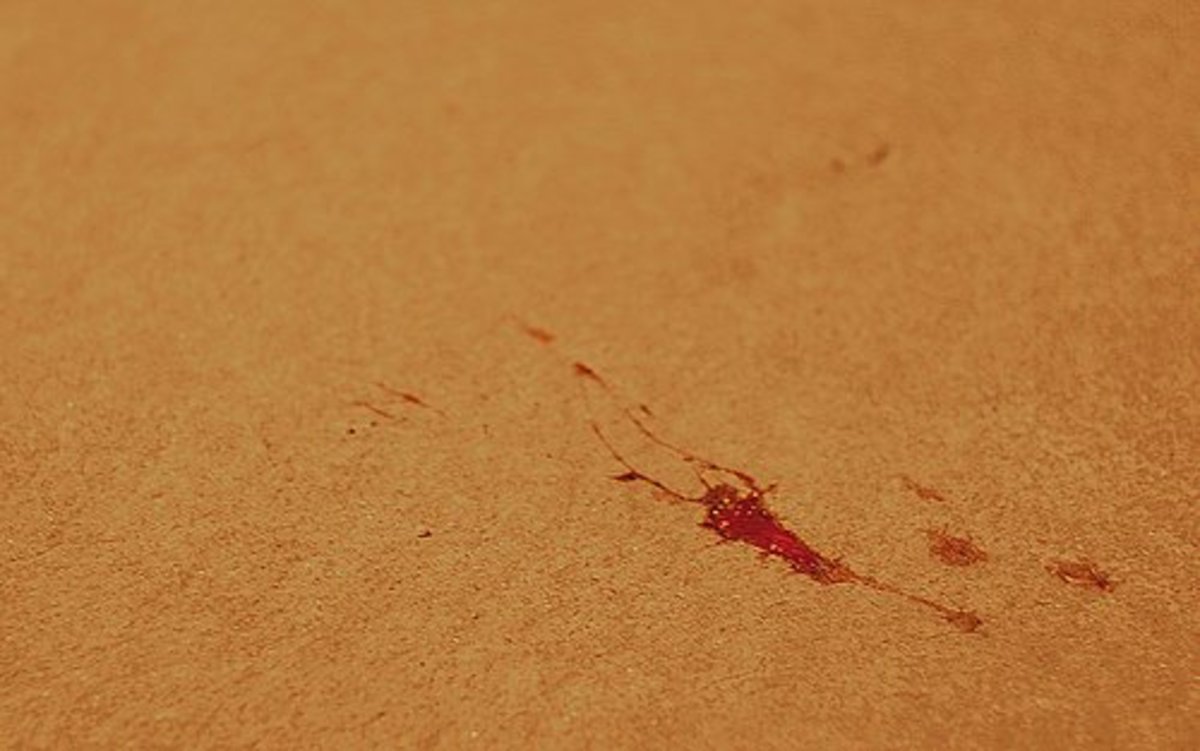 A persistently dry mouth can be more than just annoying — it may be related to a more serious issue. How to Remove Dry and Fresh Blood Stains | Dengarden