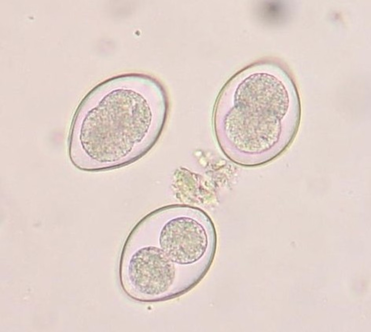 One way to ensure your c. How do Dogs Get Coccidia? | HubPages