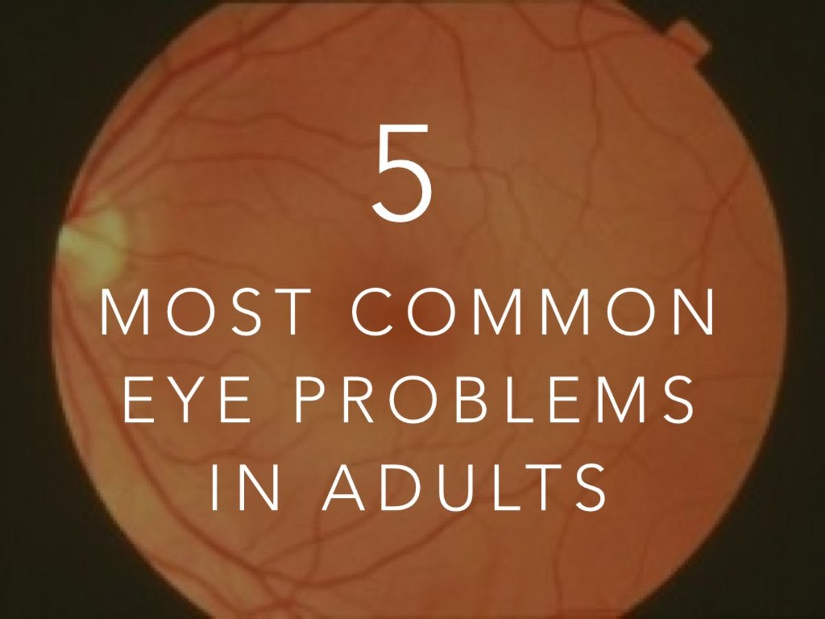 A detached retina has to be examined by an ophthalmologist right away. The Five Most Common Eye Problems in Adults | HubPages