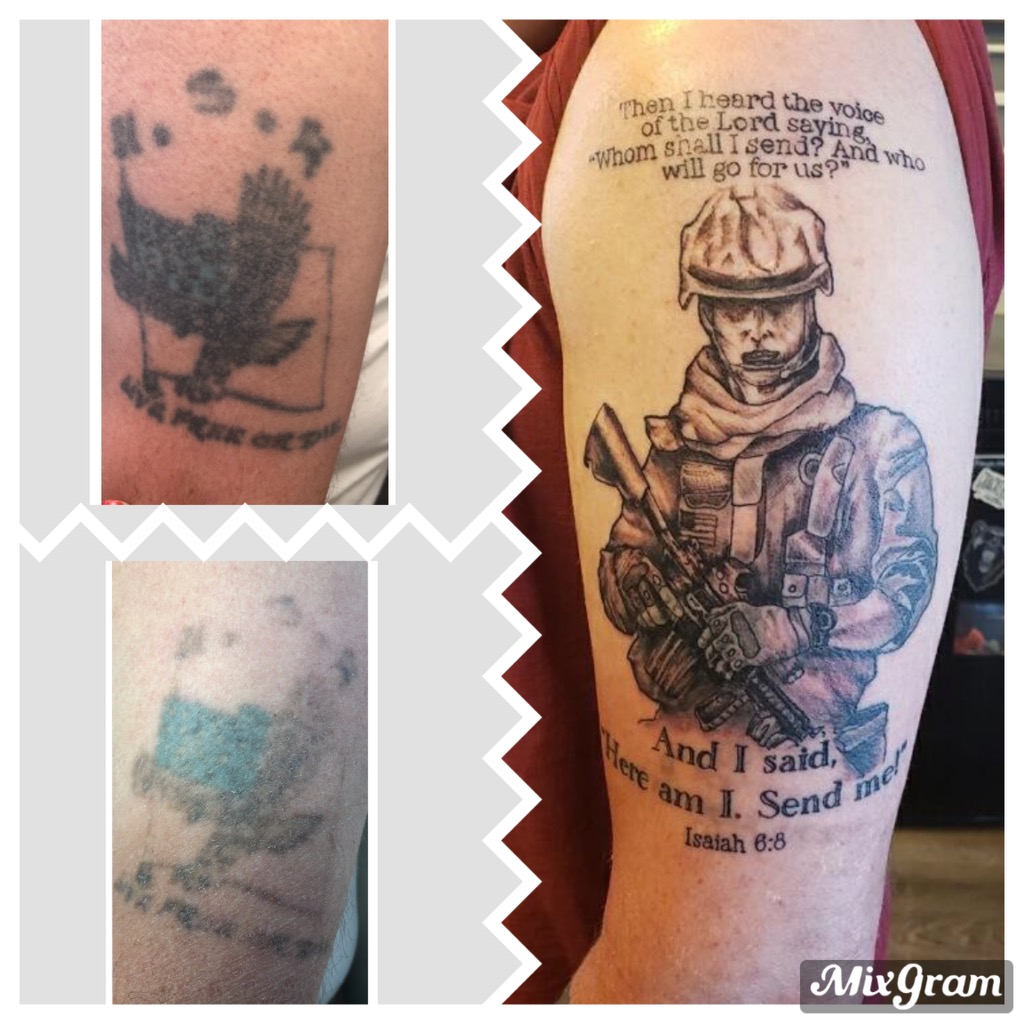 Laser Tattoo Removal Before & After Photos | Vanish Laser Aesthetics 1024_x_1024_jpg
