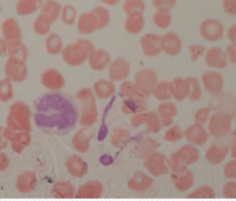 Моноциты под микроскопом как нарисовать кровь человека
