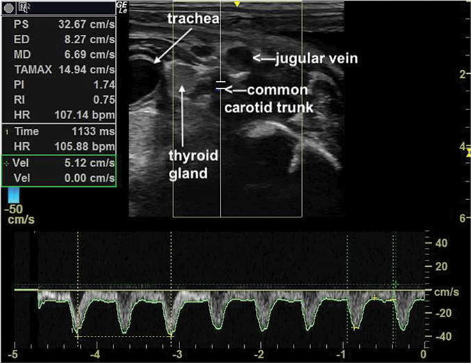 Use of Ultrasonography in Fetal Development and Monitoring | Veterian Key