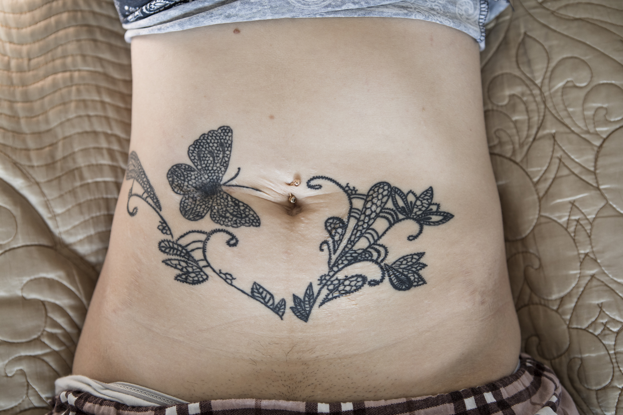 The Domestic Abuse Survivors Covering Their Scars With Tattoos 1333_x_2000_jpg