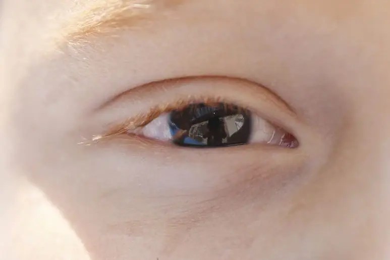 saúde ocular olho