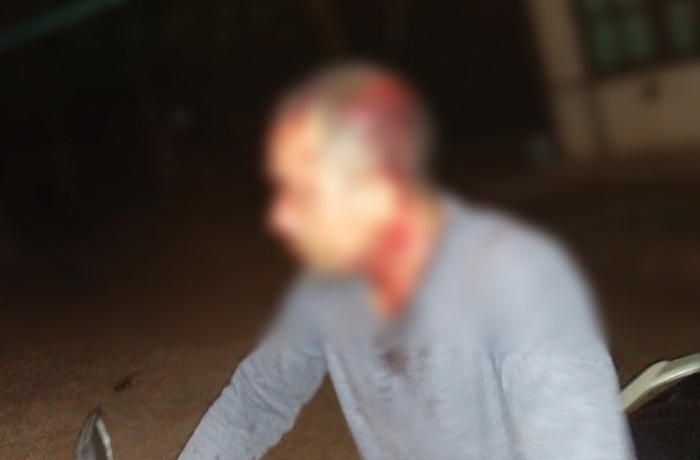 Kepala dinas pemadam kebakaran kota bekasi, aceng. Warga Matani Dibacok Hingga Kepala Bocor Pelakunya Kabur Voxntt Com