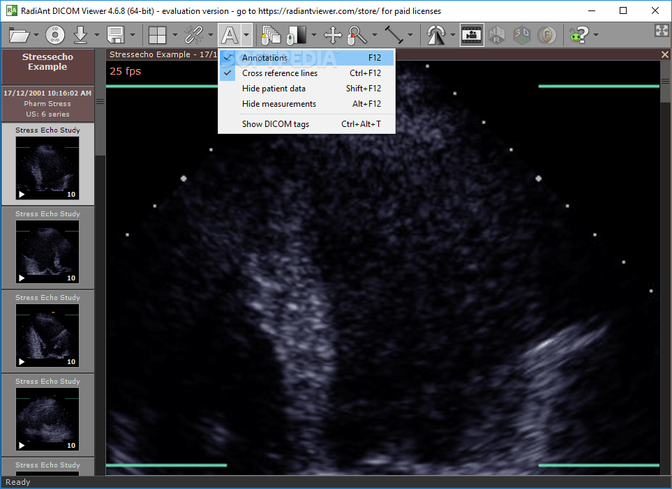 Dicom is an acronym for digital imaging and communications in medicine. Download Radiant Dicom Viewer 2021 2 2 Build 35002
