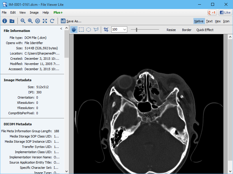 Free online dicom viewer and cloud pacs. Open Nema Dcm And Dicom Files