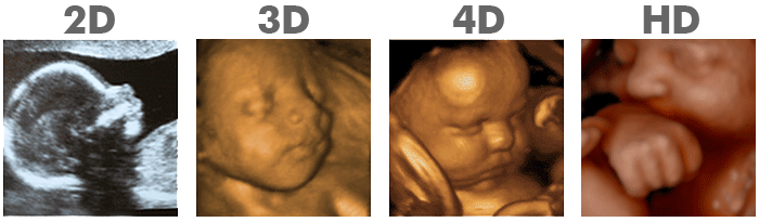 Here I Am Mommy The Home Of 3d 4d High Def Ultrasound