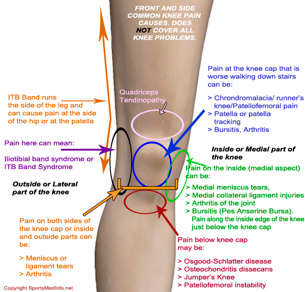 So…About that Runner’s Knee… – 110 Pounds and Counting