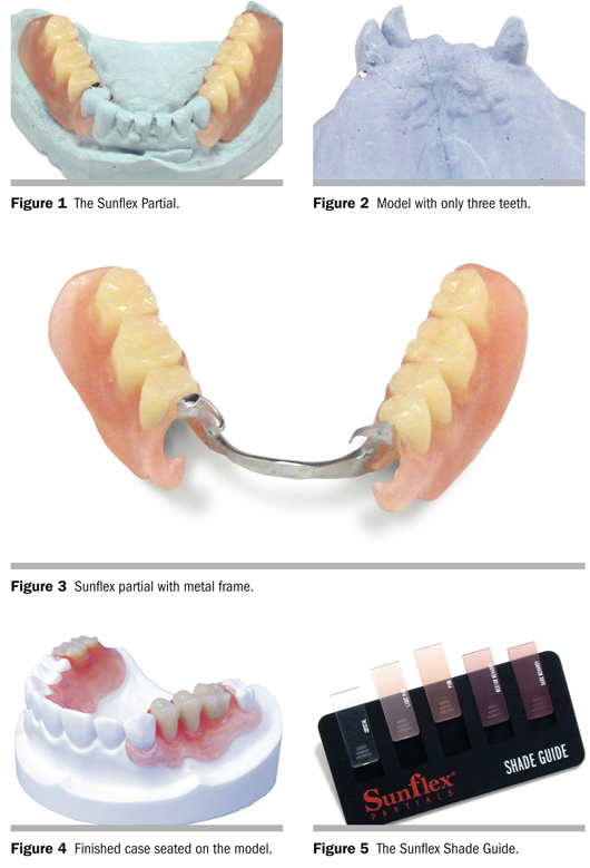 Valplast Dentures India  - It Was Long Thought That Removable Partial Dentures Had To Be Rigid To Be.