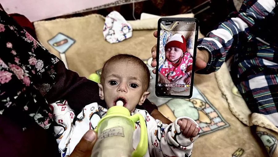 يوم الأغذية العالمي.. كارثة غذائية تهدد نحو نصف سكان قطاع غزة يوم الأغذية العالمي.. كارثة غذائية تهدد نحو نصف سكان قطاع غزة