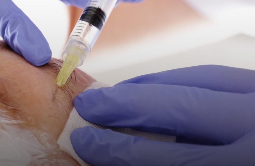 عاجل حظر محاقن التجميل.. ومهلة حتى 2026 لسحب المنتجات المخالفة