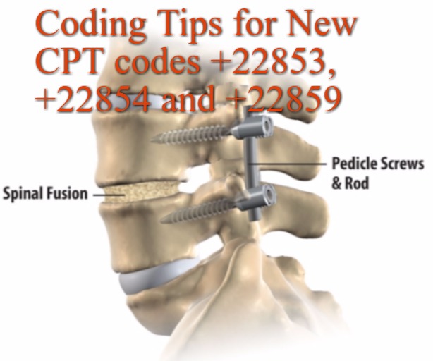 Amazing tips for New CPT codes +22853, +22854 and +22859