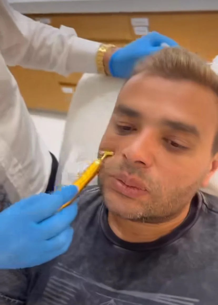 رامي صبري يخضع لعملية تجميل في الوجه 3