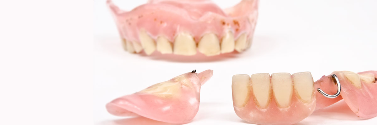 Broken Dentures Quick Fix  . This Eliminates One Of The Big Concerns Many People Have About Conventional Full If Your Denture Only Needs A Reline And Not Replacement Or Repair For An Actual Break, You May Be Able To Purchase A Reline Kit At Your Local.