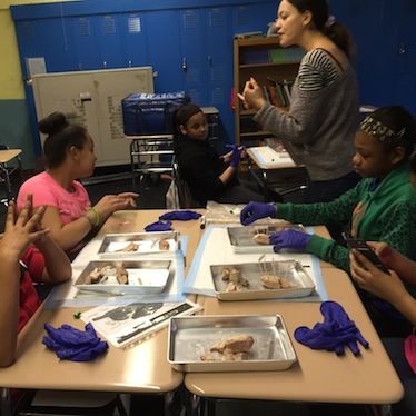 Dissecting Sheep Brains With Sixth Graders | Brains Explained