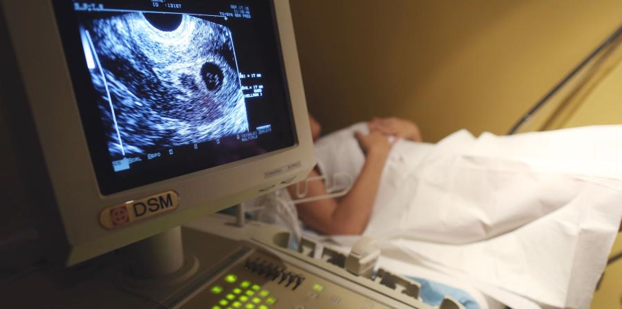 El 30% de los abortos en Camagüey se practica a niñas adolescentes