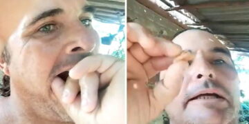 Campesino holguinero se saca una muela