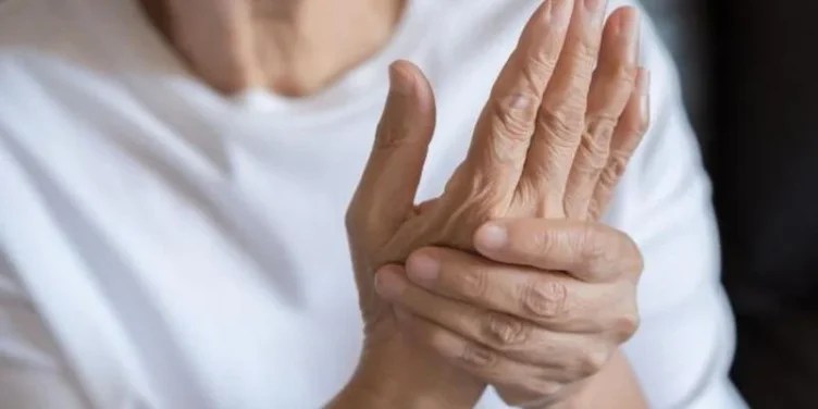 La inflamación residual tras el chikunguña puede prolongarse por semanas o meses, con periodos de mejoría y empeoramiento