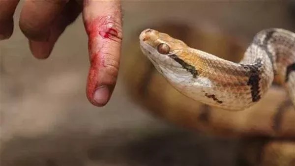 بينهم طفلة.. 8 إصابات جديدة بلدغات الثعابين والعقارب في الشرقية