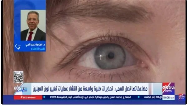 نقيب الأطباء: تغيير لون العين تجميلي ويهدد بفقدان البصر نقيب الأطباء: تغيير لون العين تجميلي ويهدد بفقدان البصر