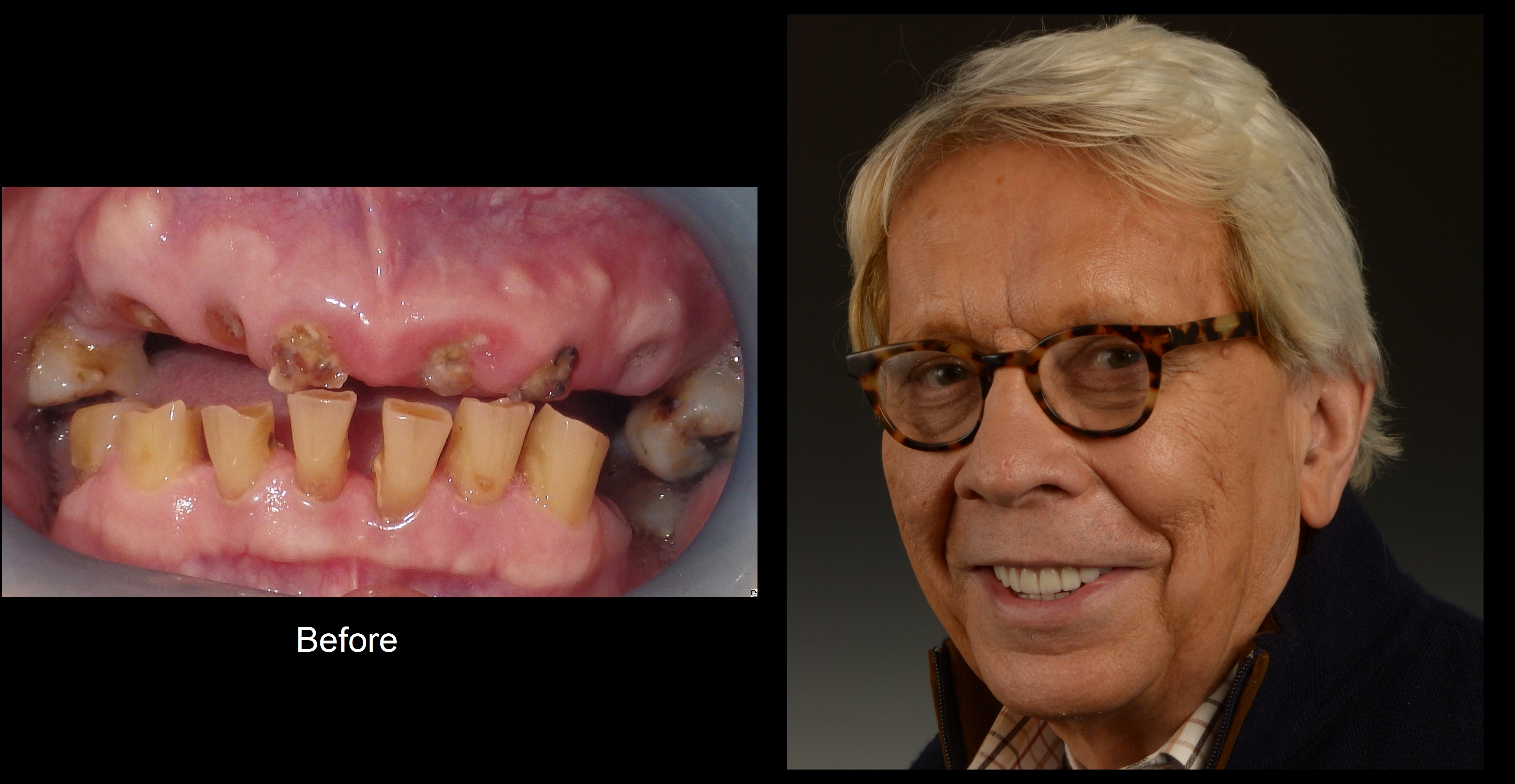 Dental Implant Financing  - Dentalcard Provides Dental Financing For Elective Medical Procedures.