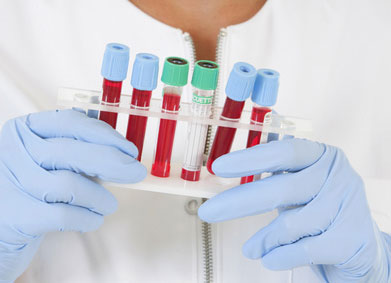 41+ Awesome Crp Wert Tabelle - Blutwerte des Esels (Blood levels of the donkey) | Esel am / Ein erhöhter wert sollte immer durch weitere .