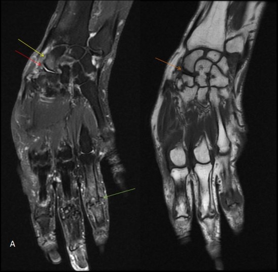 Centre d&rsquo;imagerie Ostéo-Articulaire | Clinique du sport de Bordeaux