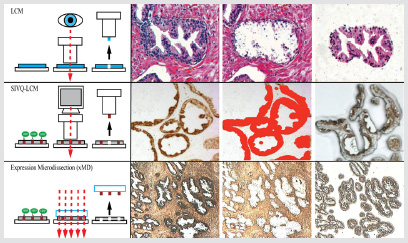 09/01/2017 · in tumor pathology molecular biology techniques are used to diagnose and subclassify tumors, predict response to therapies and identify therapeutic targets. Molecular Histopathology Intechopen