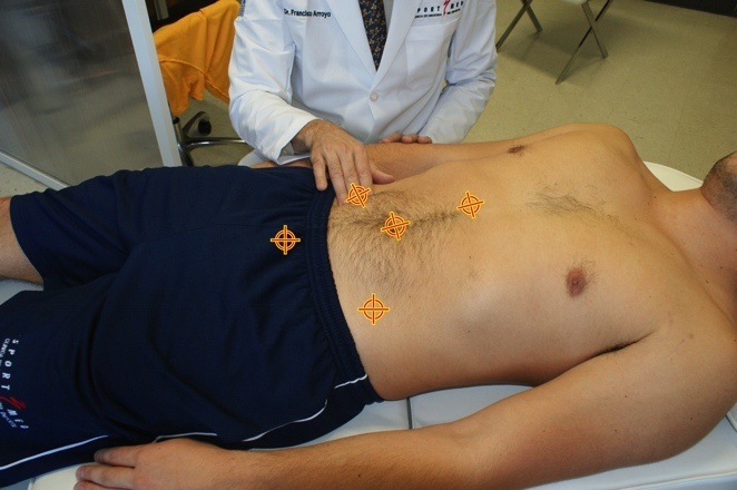 A limited number of muscle fibres are torn. Overview Of Different Location Of Muscle Strain Intechopen