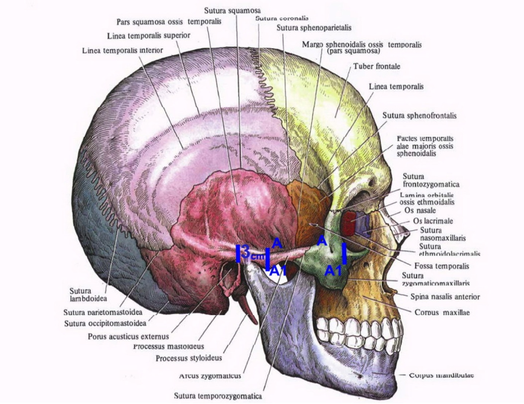 The lacrimal bone is perhaps the most fragile bone of the face and one of the smallest bones in the body. Serdev Sutures In Middle Face Intechopen