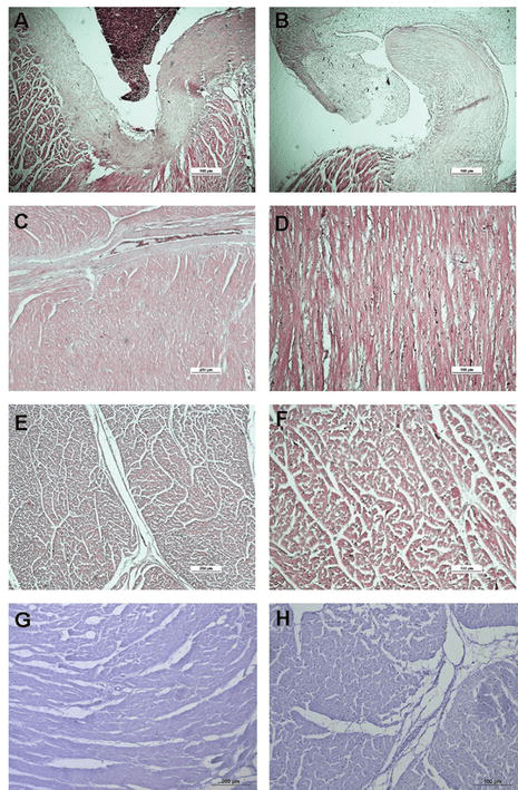 Birds pollinate our plants, control bugs and pests, and even provide fertilizer for gardens and. Avian Cardiovascular Disease Characteristics Causes And Genomics Intechopen
