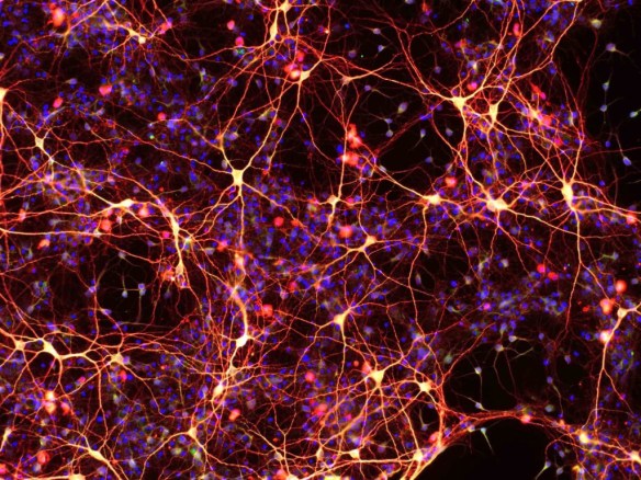 positive news on the stem cell front today √ Big stem cell news: dynamic duo of all-chemical direct reprogramming reports