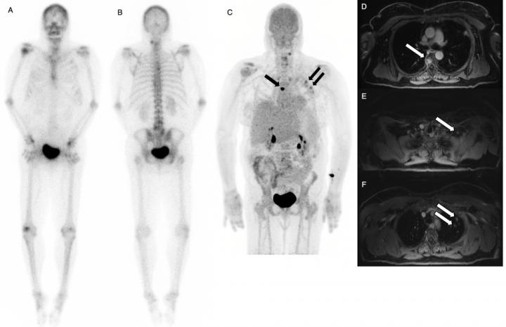 The pancreas is a bodily organ that few people think about. Dual-Agent PET/MR With Time of Flight Detects More Cancer