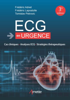 John Libbey Eurotext - ECG en urgence (3e édition) - Cas cliniques –  Analyses ECG – Stratégies thérapeutiques - Frédéric Adnet, Frédéric  Lapostolle, Tomislav Petrovic