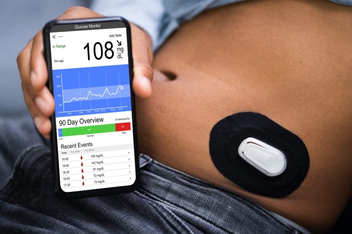 Dexcom G6 for continuous glucose monitoring – NASGP Dexcom g7 not pairing with android