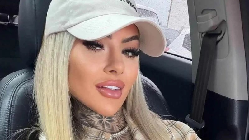 عملية تجميل تنهي حياة &laquo;نجمة إنستغرام&raquo;